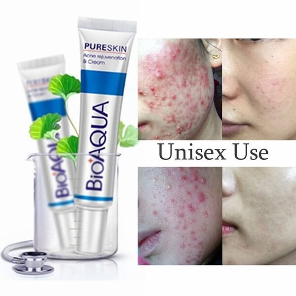 Buy Bio Aqua Acne Removal Cream Online in pakistan sanwarna.pk