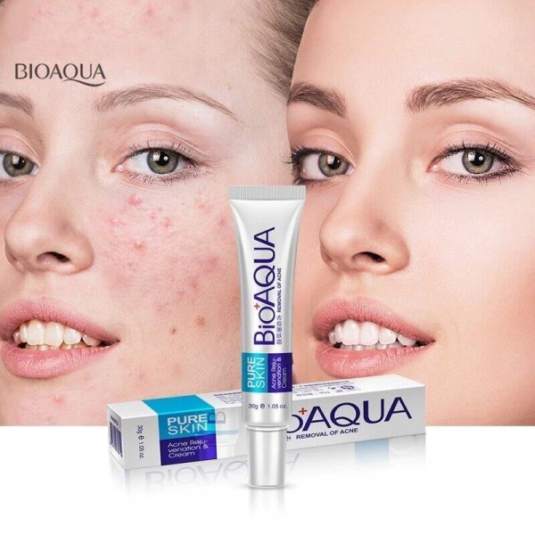 Buy BIOAQUA Anti Acne Cream Treatment Acne in pakistan sanwarna.pk