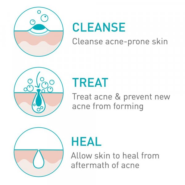 cerave acne foaming cream cleanser ingredients