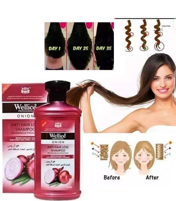 wellice onion shampoo benefits