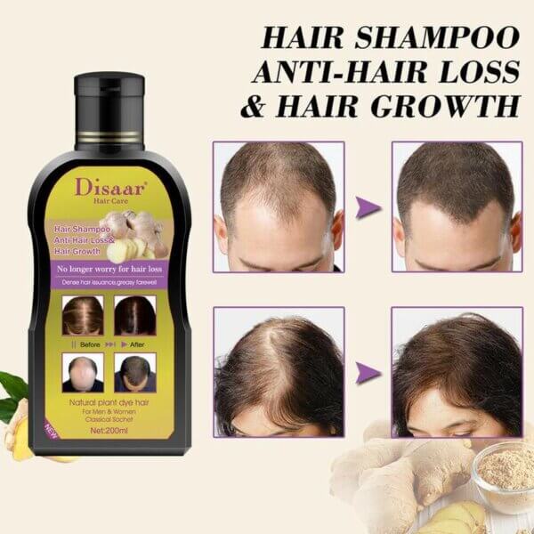 ginger shampoo for hair loss